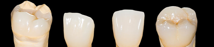 laboratoire de protheses dentaires eguilles-implants dentaires aix-en-provence-protheses ajointes Salon-de-Provence-protheses conjointes Bouches-du-Rhone-protheses dentaires Martigues-laboratoire dentaire Eguilles-prothesiste dentaire Aix-en-Provence