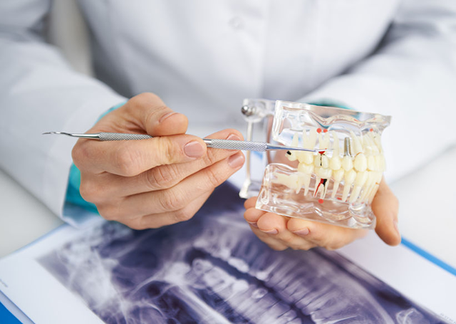 laboratoire de protheses dentaires eguilles-implants dentaires aix-en-provence-protheses ajointes Salon-de-Provence-protheses conjointes Bouches-du-Rhone-protheses dentaires Martigues-laboratoire dentaire Eguilles-prothesiste dentaire Aix-en-Provence