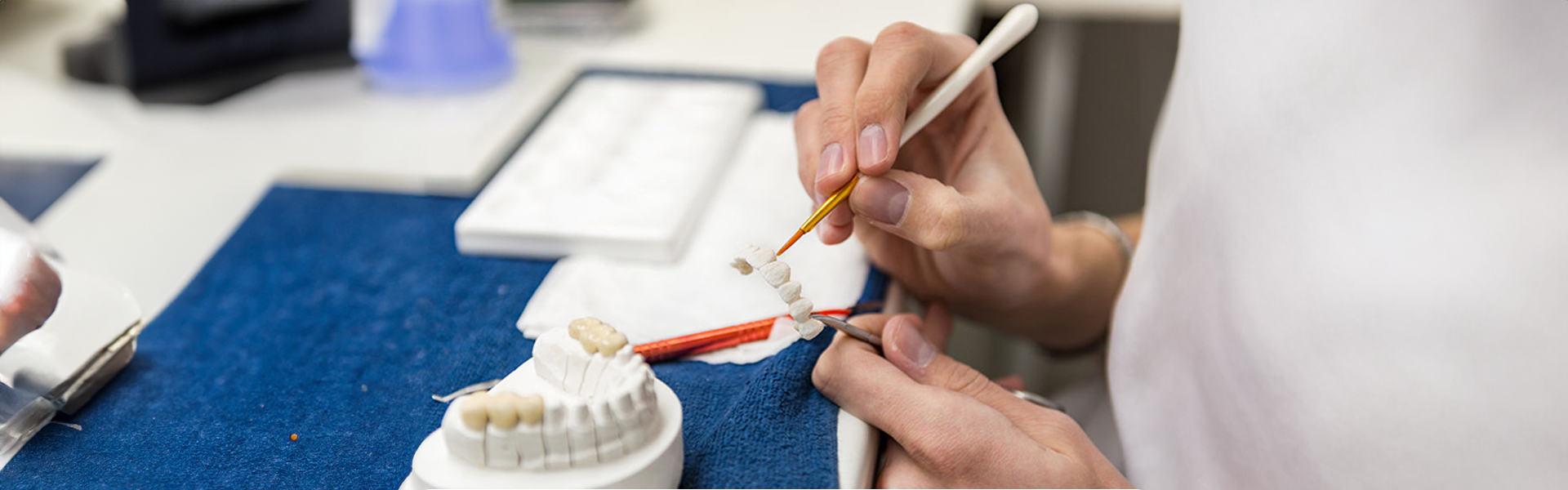 Prothèse Dentaire Laboratoire à Marseille - Laboratoire Bertrand